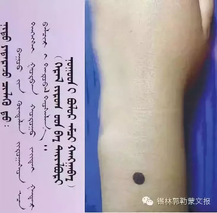 神奇的蒙古医学传统推拿按摩术(蒙古文) 第6张 神奇的蒙古医学传统推拿按摩术(蒙古文) 第6张